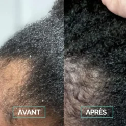 In Haircare Sérum cheveux croissance Boost & Scalp - 50 ml