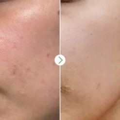 Pai Skincare Booster Super Apaisant Tri-Mushroom - 10 ml