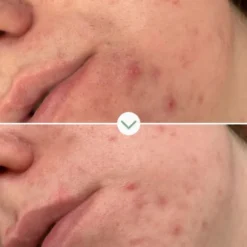 Pai Skincare Gel nettoyant Phaze - 100 ml