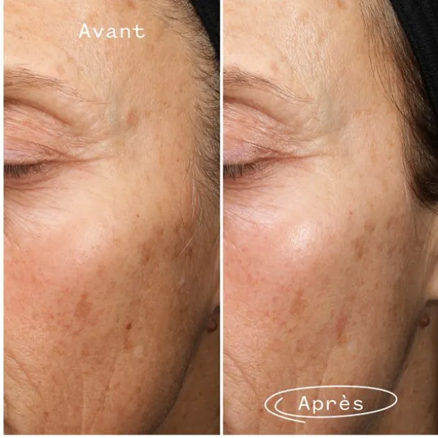 Pai Skincare Sérum Anti-Taches aux Algues Marines Fade Forward - 30 ml