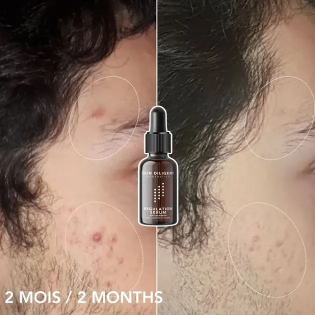 Skin Diligent Sérum regulation
