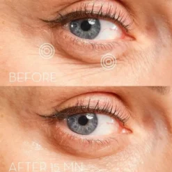 Skin Office Paris Patchs contour des yeux Eye Precision