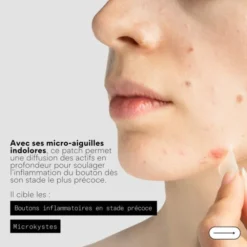 Skin & Out Patchs micro-aiguilles stop-boutons Clear Out x9