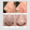 Skin & Out Patchs nez purifiants Peel Out x5