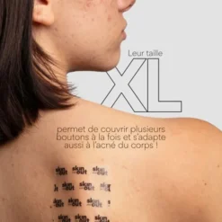 Skin & Out Patchs XL boutons hydrocolloïde Clear Out x8